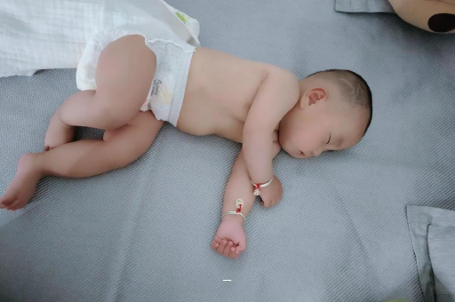 乐山宝宝脸上有白色斑块